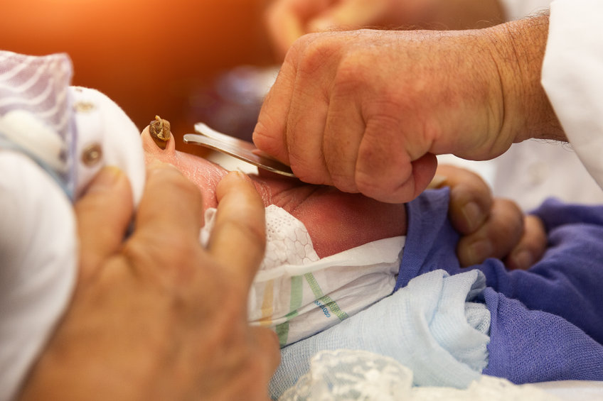 Comment choisir le bon centre de circoncision pour mon enfant ?